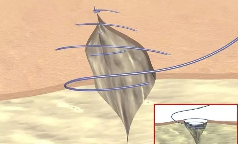 看图区分外科缝线，学习缝合小秘诀